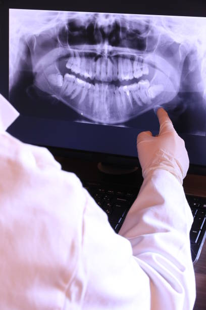 Best Emergency Dental Extractions in Alexander, AR
