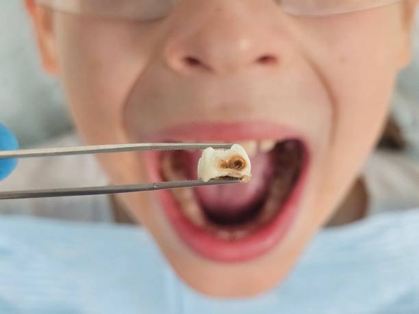 Best Broken or Cracked Tooth Emergency Dentist in Alexander, AR